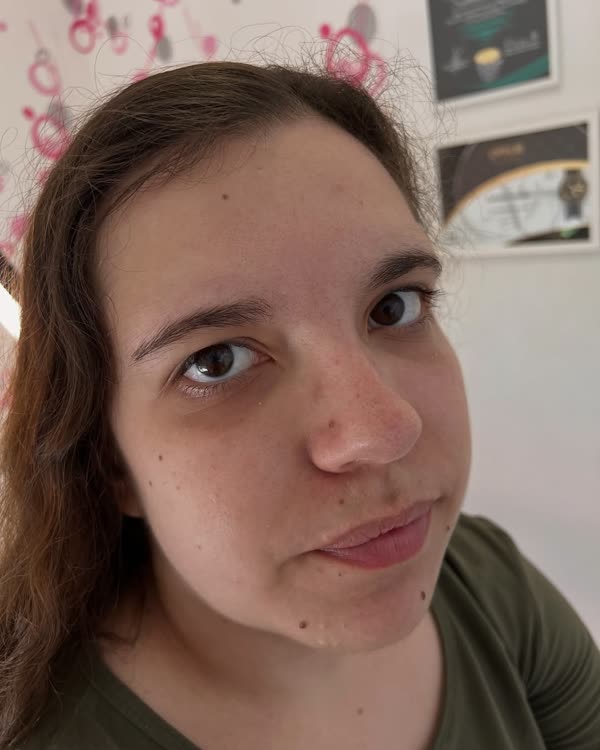 Obrve pre tretmana, primer 7